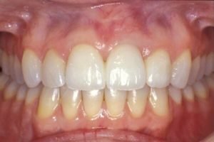 teeth