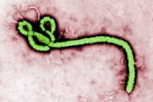 ebola virus