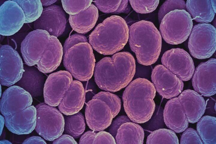 neisseria gonorrhoeae