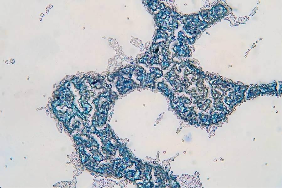 Saccharomyces cerevisiae, also known as brewer’s yeast, is seen under a microscope. This species is used around the world to make food and beverages. Easily cultured with a well-known genome, the species has also become a favorite of synthetic biologists for making natural products that are difficult to obtain from their native sources. (Credit: tonaquatic/iStock)