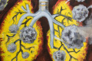 Lungs