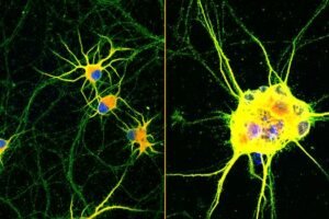 Fluorescent images of human neurons (stained with red, green and blue) growing on coatings with fast-moving molecules (left) or conventional laminin (right) for 60 days. Neurons spread homogenously and showed more complex branching on the highly mobile coating developed at Northwestern.