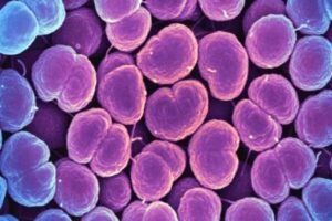 Scanned electron micrograph image of Neisseria gonorrhoeae bacteria, which can cause gonorrhea.