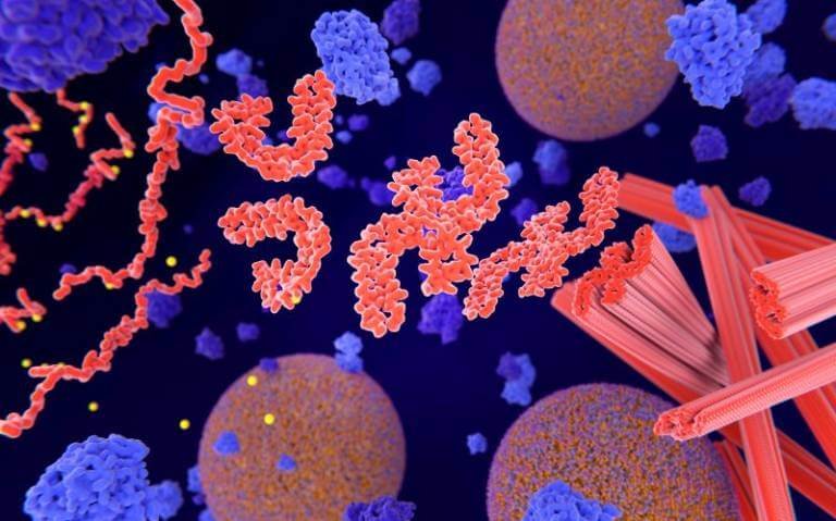 Pathological phosphorylation (yellow) of Tau proteins (red-orange) leads to disintegration of microtubuli in the neuron axon an aggregation of the tau proteins. The transport of synaptic vesicles (orange-blue) is interrupted. Credit: selvanegra on iStock