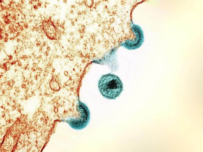 Transmission electron micrograph of HIV-1 virus particles from infected H9 cells, produced in cell culture. The particles exhibit two stages of replication: the two “arcs” are immature particles budding from the plasma membrane of the cell, and the center spherical particle is a mature form in extracellular space. Image captured at the NIAID Integrated Research Facility (IRF) in Fort Detrick, Maryland.
