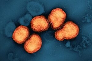 A colorized transmission electron micrograph of influenza A virus particles, colorized orange, isolated from a patient sample and then propagated in cell culture. NIAID
