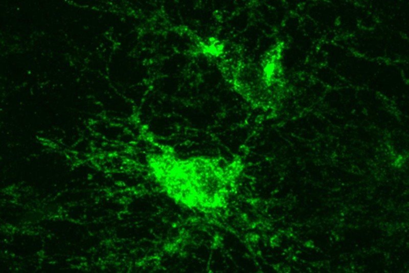 Oligodendrocyte precursor cells (OPCs) in vivo. Image by Erin Gibson.
