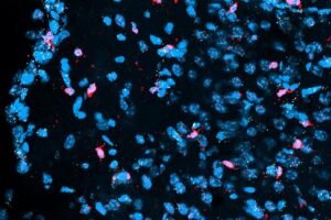 A section of a mouse juvenile brain (cerebral cortex) showing cell nuclei (blue), microglia (red) and the activation of a specific gene called Hes1 (white).