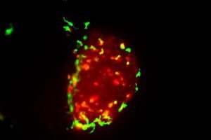 Still image from a 21-hour video showing a human bladder tumour (red) being cleared by zebrafish macrophages (green)