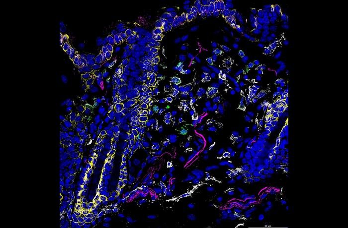 Immunofluorescence imaging showing nerve terminals (magenta) innervating keratinocytes (yellow) and myeloid cells (white) that express IL-33 (green) in naive murine skin. (Image: Courtesy of Camila Napuri)