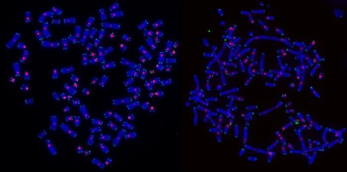 Chromosomes from cancer cells with DNA stained blue, telomeres stained green, and centromeres stained pink.