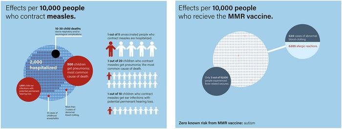 Comparing the risk of 10,000 children acquiring measles (left) versus receiving the measles-mumps-rubella (MMR) vaccine.