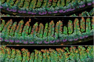 The gut epithelium of virgin (top), pregnant (middle), and lactating (bottom) mice, highlighting villus growth.