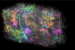 brain connections