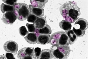 A closeup of leishmaniasis